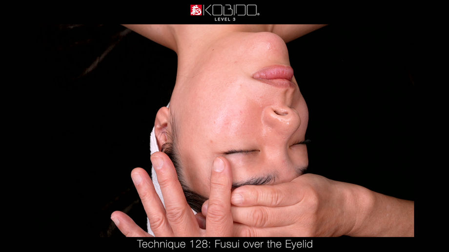 Technique 128: Fusui over the Eyelid